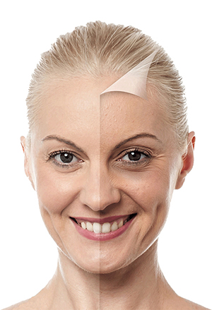 Wrinkles - Symptoms and causes